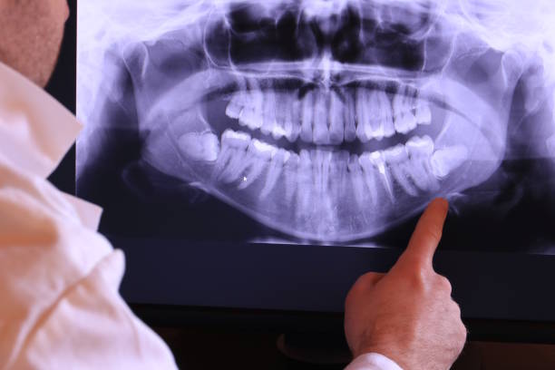 Best Emergency Dentist for Special Needs Patients in Mission, KS