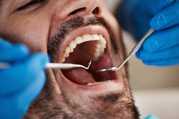 Best Mobile Emergency Dentist in Mission, KS